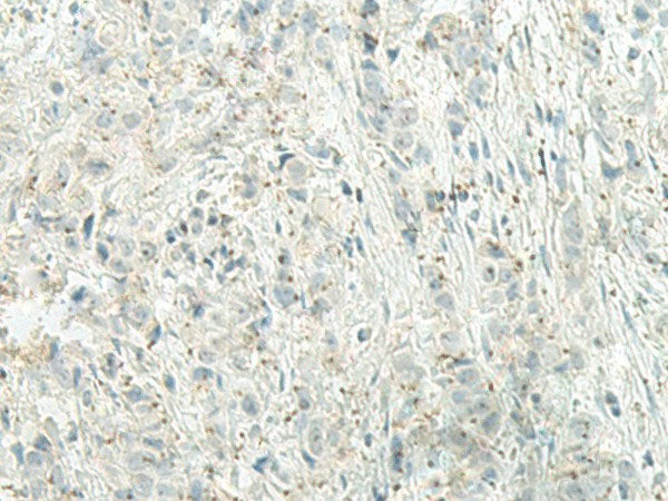 UQCC2 Polyclonal Antibody Reactivity Human