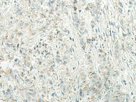 UQCC2 Polyclonal Antibody Reactivity Human