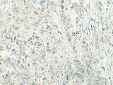 UQCC2 Polyclonal Antibody Reactivity Human