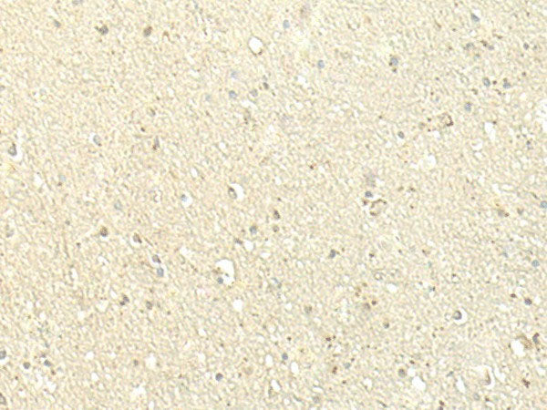 SPIRE1 Polyclonal Antibody
