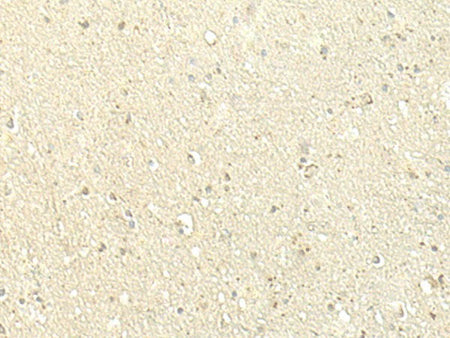SPIRE1 Polyclonal Antibody