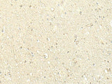 SPIRE1 Polyclonal Antibody