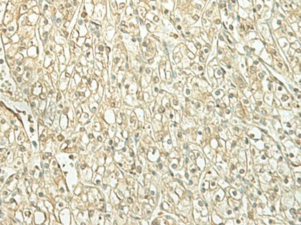 SPIRE1 Polyclonal Antibody