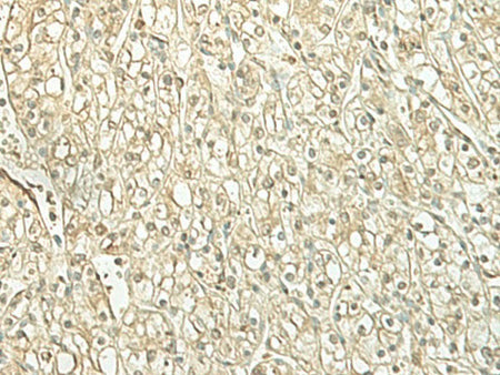 SPIRE1 Polyclonal Antibody