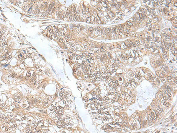 SNRNP25 Polyclonal Antibody Reactivity Human