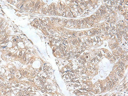 SNRNP25 Polyclonal Antibody Reactivity Human