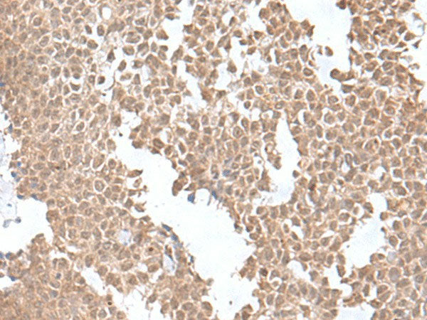 SNRNP25 Polyclonal Antibody Reactivity Human