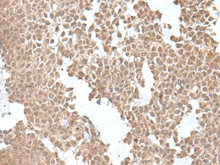SNRNP25 Polyclonal Antibody Reactivity Human