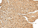 RPS12 Polyclonal Antibody Reactivity Human