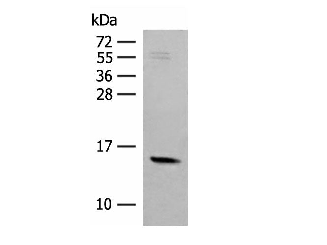 RPS12 Polyclonal Antibody Reactivity Human