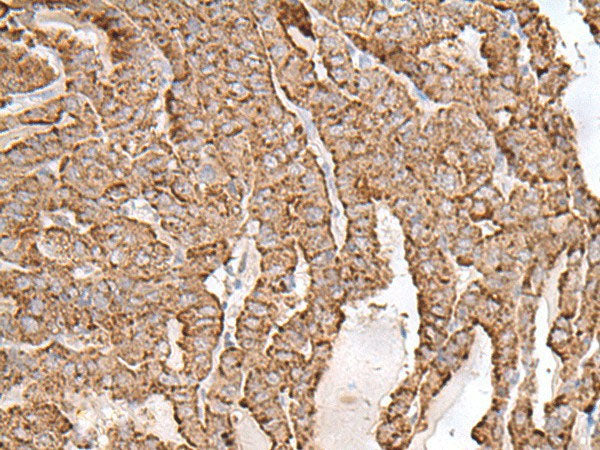 AP1S1 Polyclonal Antibody Reactivity Human