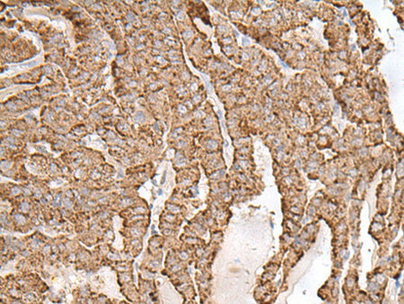 AP1S1 Polyclonal Antibody Reactivity Human