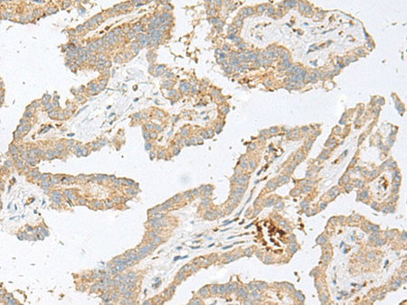 HBG1/HBG2 Polyclonal Antibody Reactivity Human