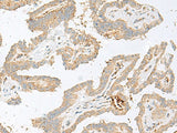 HBG1/HBG2 Polyclonal Antibody Reactivity Human