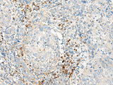 HBG1/HBG2 Polyclonal Antibody Reactivity Human