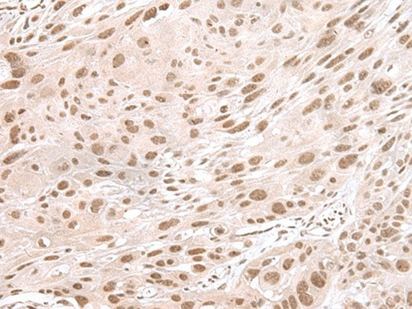 MAGOHB Polyclonal Antibody Reactivity Human