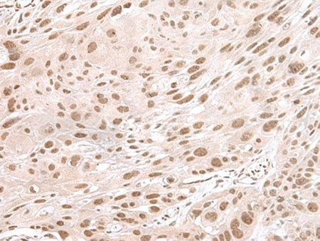 MAGOHB Polyclonal Antibody Reactivity Human