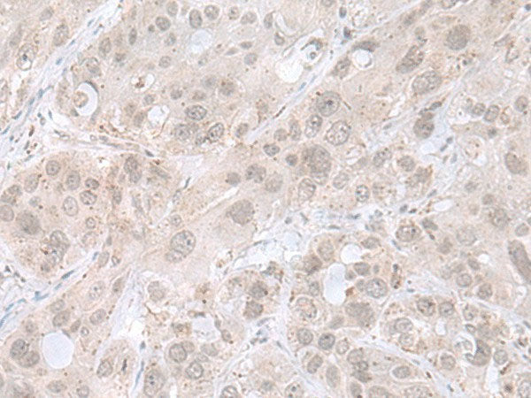 THAP12 Polyclonal Antibody Reactivity Human