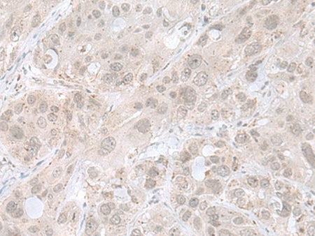 THAP12 Polyclonal Antibody Reactivity Human