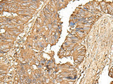 UBE2A Polyclonal Antibody Reactivity Human