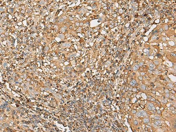 UBE2A Polyclonal Antibody Reactivity Human