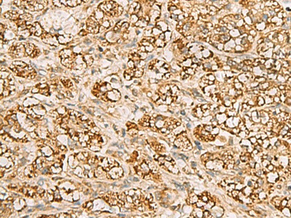 MTAP Polyclonal Antibody Reactivity Human