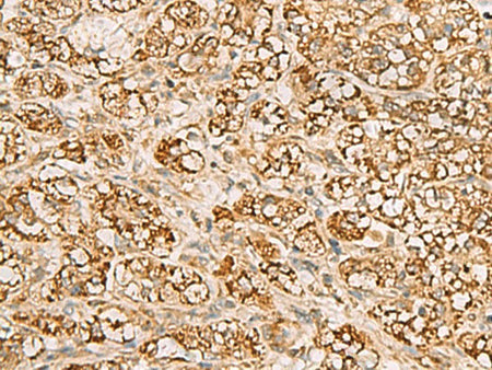 MTAP Polyclonal Antibody Reactivity Human