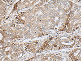 MRM1 Polyclonal Antibody Reactivity Human