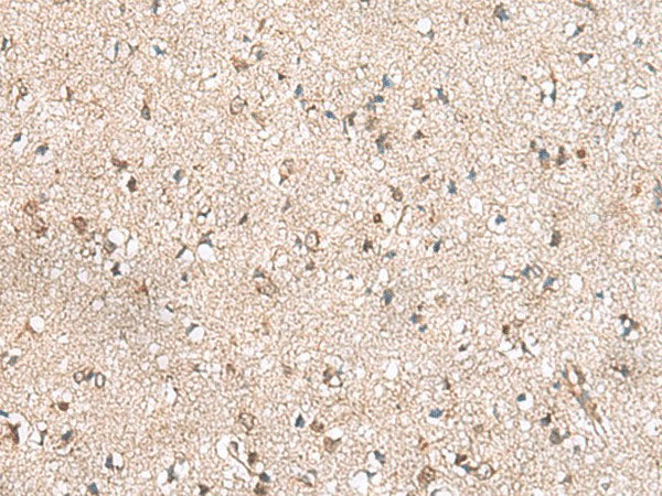 RPL23A Polyclonal Antibody Reactivity Human