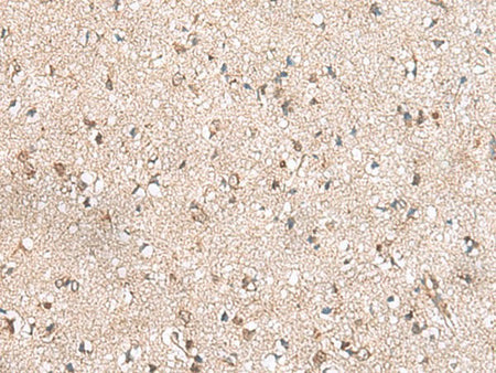 RPL23A Polyclonal Antibody Reactivity Human