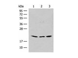 RPL23A Polyclonal Antibody Reactivity Human