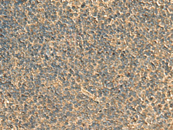 RPS11 Polyclonal Antibody