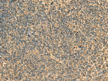 RPS11 Polyclonal Antibody