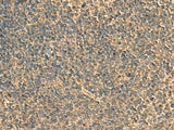 RPS11 Polyclonal Antibody