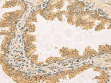 RPS11 Polyclonal Antibody