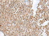 GLYAT Polyclonal Antibody Reactivity Human