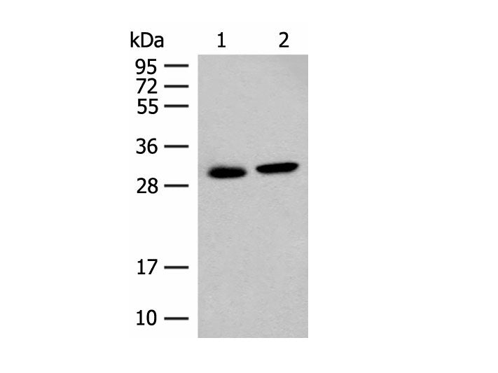 GLYAT Polyclonal Antibody Reactivity Human