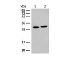 GLYAT Polyclonal Antibody Reactivity Human