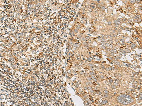 ZC3H7A Polyclonal Antibody Reactivity Human