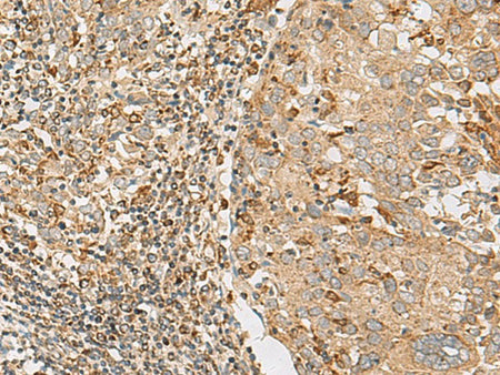 ZC3H7A Polyclonal Antibody Reactivity Human