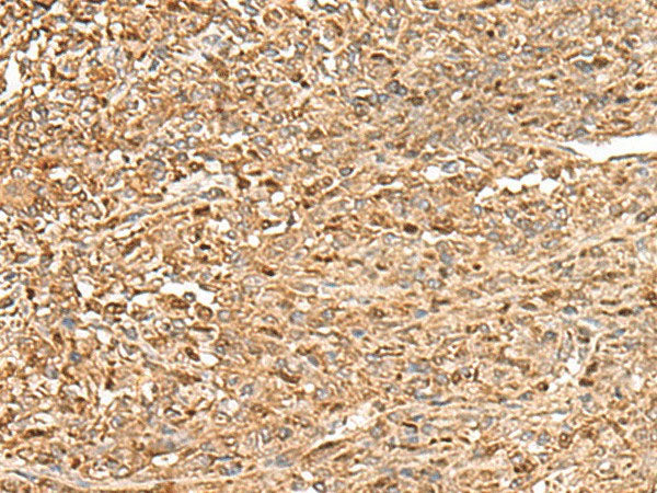 ZC3H7A Polyclonal Antibody Reactivity Human