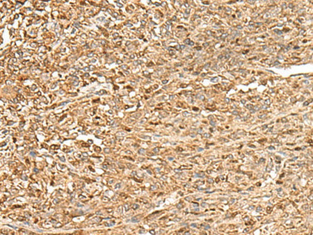 ZC3H7A Polyclonal Antibody Reactivity Human