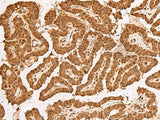 TIPRL Polyclonal Antibody Reactivity Human