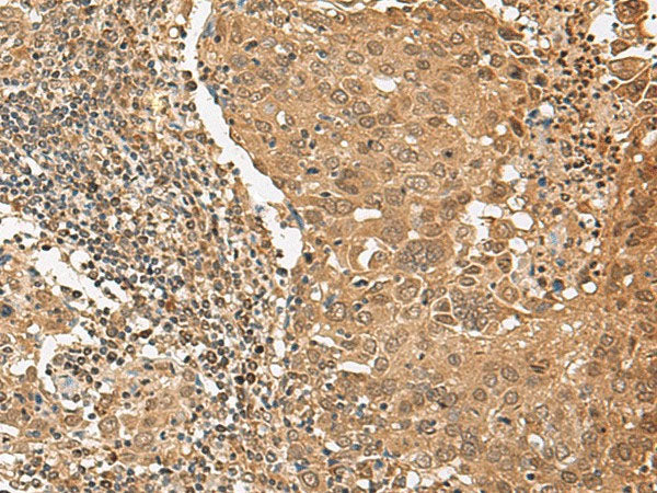 TIPRL Polyclonal Antibody Reactivity Human