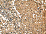 TIPRL Polyclonal Antibody Reactivity Human