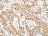 SEC11A Polyclonal Antibody