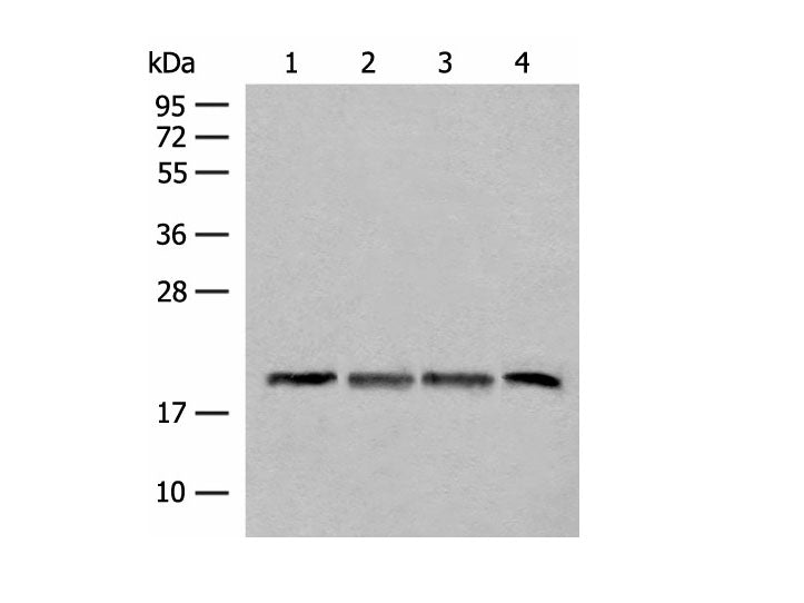 SEC11A Polyclonal Antibody