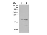 RNF5 Polyclonal Antibody Reactivity Human