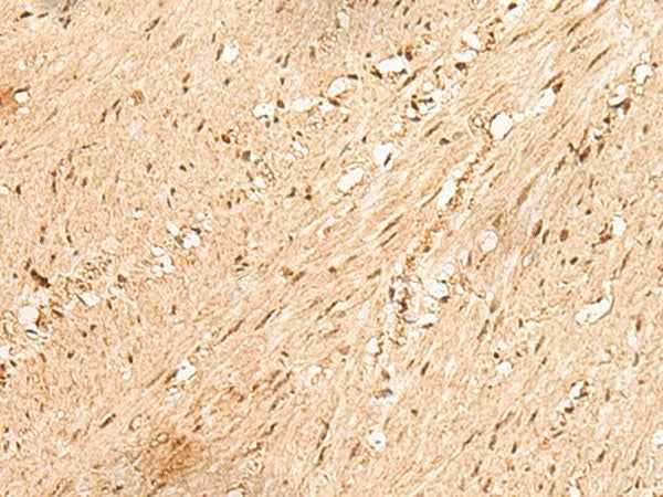 JPT2 Polyclonal Antibody Reactivity Human