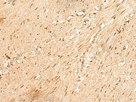 JPT2 Polyclonal Antibody Reactivity Human